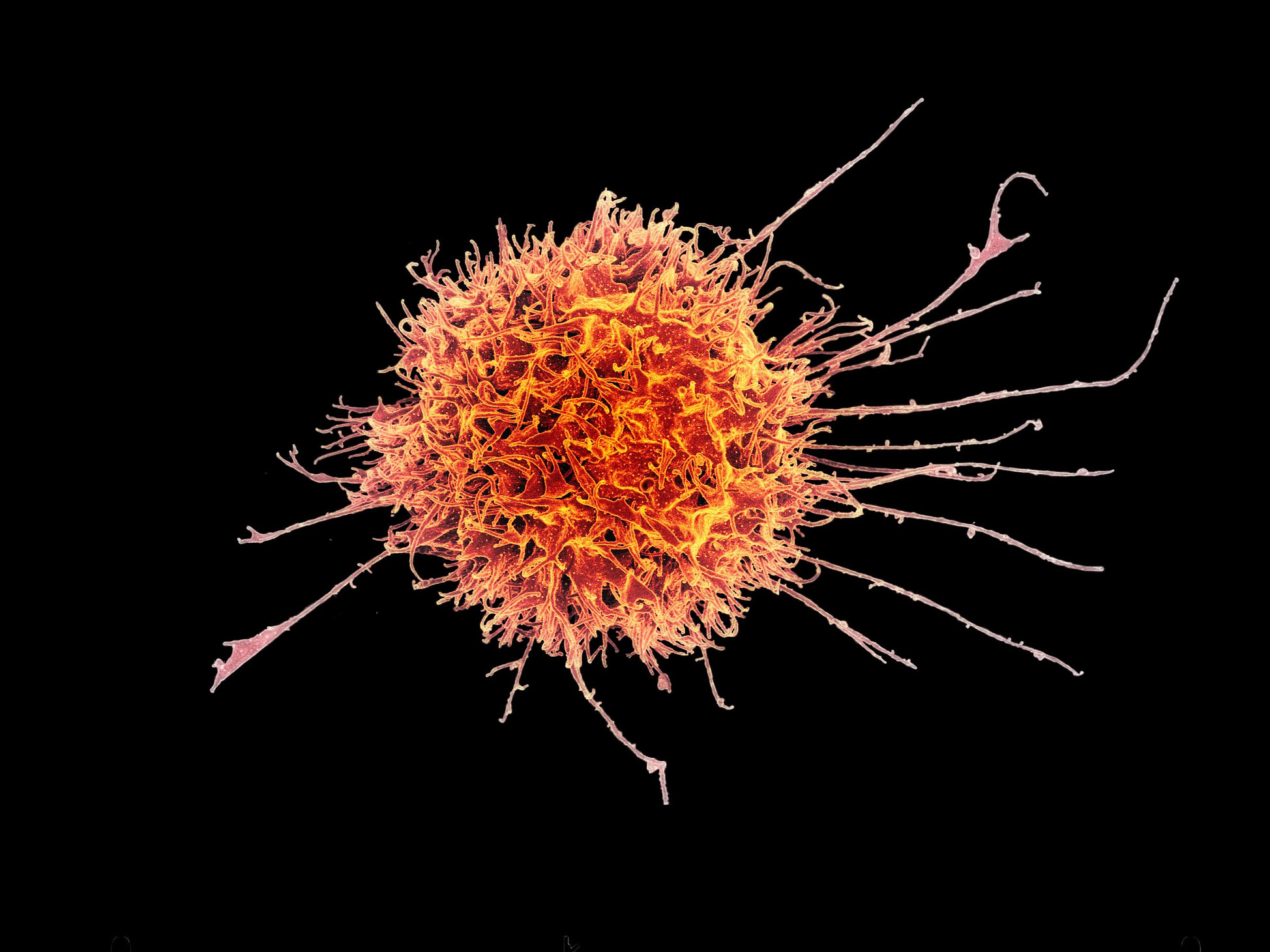 NK buňka lidského imunitního systému je schopná rozeznat virem napadenou nebo nádorovou buňku a zlikvidovat ji
