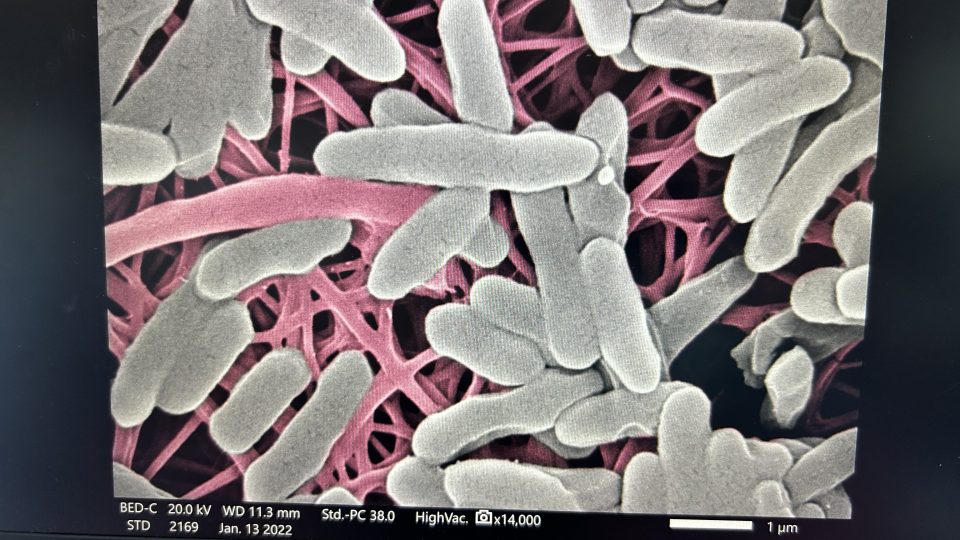 Čeští vědci přišli s nanoobvazem, který ničí bakterie přímo v ráně