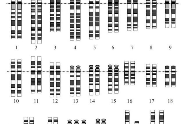 Downův syndrom vyvolává přítomnost třetí kopie 21. chromozómu | foto:  NHGRI,  licence Public Domain  (eng)