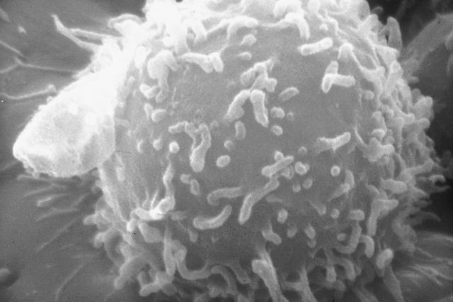 Lymfocyt | foto: National Cancer Institute