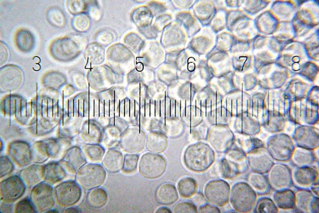 Pekařské kvasinky  (Saccharomyces cerevisiae) | foto: licence Creative Commons Attribution 3.0 Unported,  Bob Blaylock