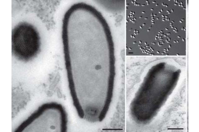 Pithovirus sibericum - snímek z elektronového mikroskopu | foto:  Matthieu Legendre et al