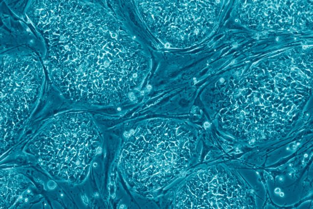Lidské embryonální kmenové buňky | foto: licence Creative Commons Attribution 2.5,   Nissim Benvenisty