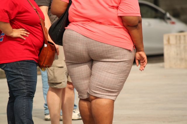 Máte nějaké to kilo navíc? Uvažujte o liposukci? | foto: CC0 Public domain,   Cocoparisienne