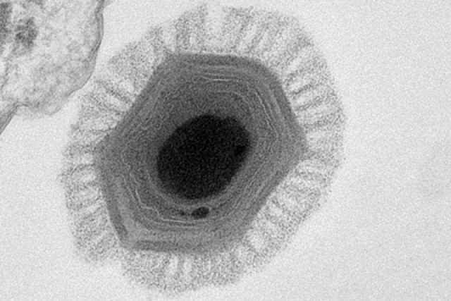 Megavirus | foto: licence Creative Commons Attribution-ShareAlike 3.0 Unported,   Chantal Abergel