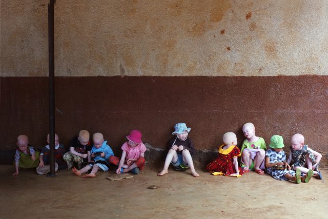 Internát-ochranný tábor pro děti s albinismem a jiným hendikepem u města Shinyanga-škola Buhangija. PROHLÉDNĚTE SI DALŠÍ FOTOGRAFIE V ČLÁNKU. | foto: Jan Prokeš