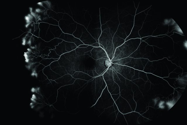 Cévy sítnice lidského oka | foto: ZEISS Medical Technology