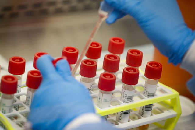 Testování na koronavirus | foto: John Minchillo,  ČTK/AP