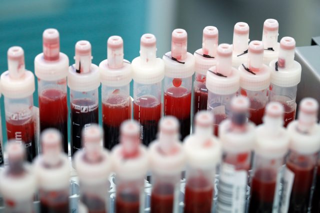 Vzorky krve připravené k testování na přítomnost koronaviru | foto: Axel Schmidt,  Reuters