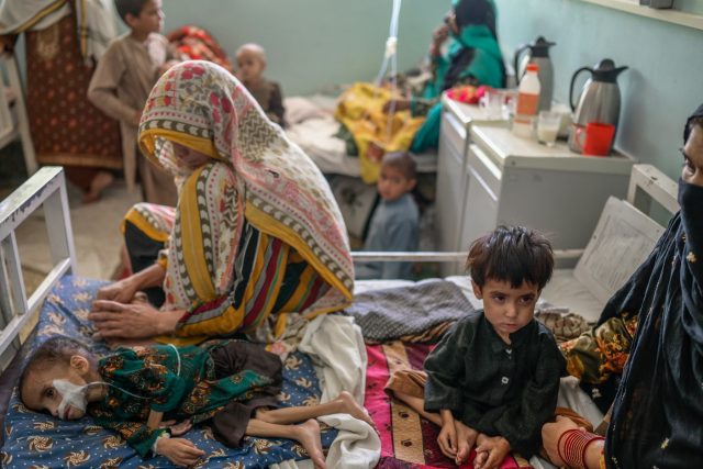 Nemocnice v Afghánistánu se plní podvyživenými dětmi,  kterých kvůli krizi neustále přibývá | foto: Profimedia