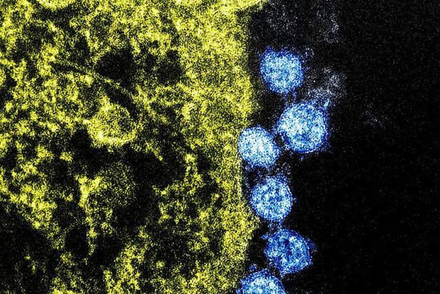 Koronavirus SARS-CoV-2 způsobující onemocnění COVID-19 pod elekronovým mikroskopem  | foto: WASHINGTON,  D.C. - DOD,  Other Government Departments Take Coronavirus Response Measures,  U.S. Indo-Pacific Command,  CC0 1.0