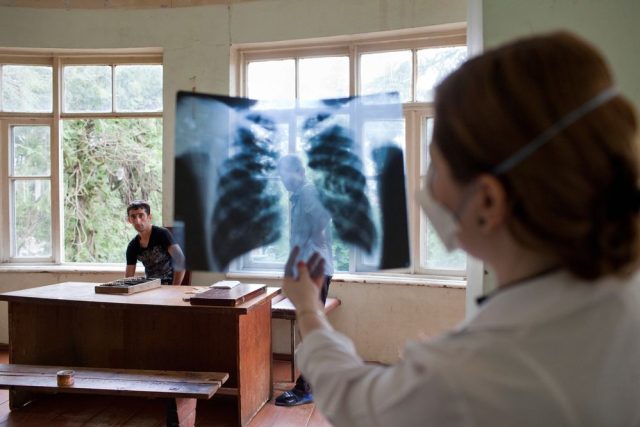 Tuberkulóza: lékařka v centru pro infekční choroby,  AIDS a tuberkulózu v gruzínském Batumi prohlíží rentgenový snímek.  | foto: Daro Sulakauri,  Lékaři bez hranic