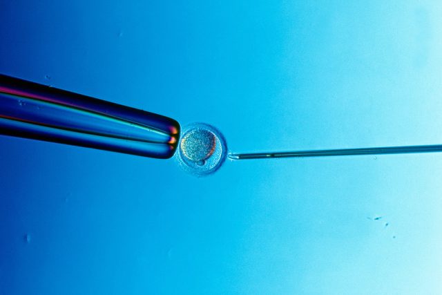 Umělé oplodnění IVF  (ilustrační foto) | foto: Profimedia